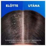 Head & Shoulders Classic Clean Korpásodás Elleni Sampon 400 ml