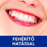 Colgate Cavity Protection fogkrém 75 ml